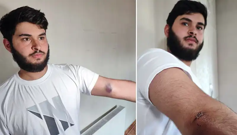 Bahçeye Kaçan Top, Mahallede İnanılmaz Bir Kaosa Sebep Oldu